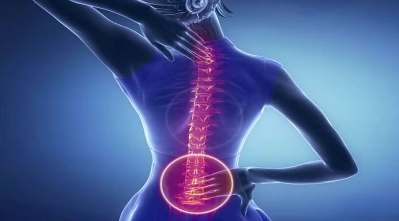 Osteocondrosis of the spine