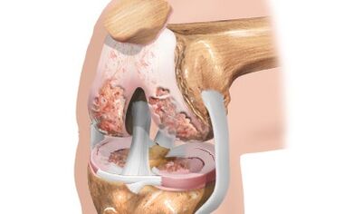 Scheme of ligaments