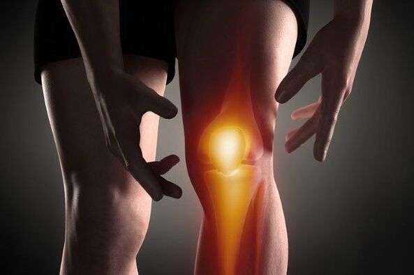 Artrosis of knee joint