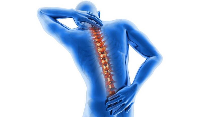 What is back pain