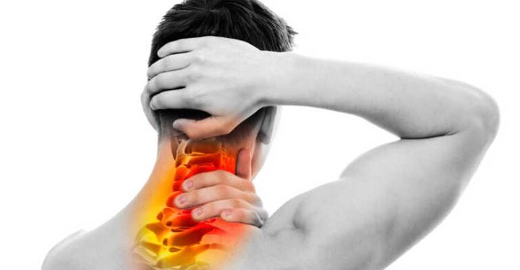 Nape signs of pain and osteocondrosis in the neck