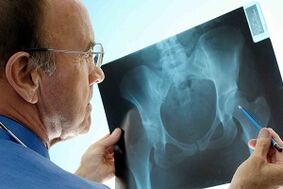 X -Ray hip joint arterry